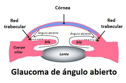 Ángulo Abierto